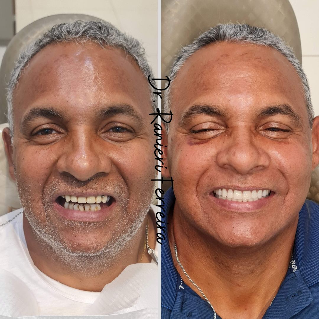 Antes do tratamento odontológico